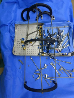 【最新病例】三臂十一軸機(jī)器人輔助器牽引——骨折外固定術(shù)骨折案例分享